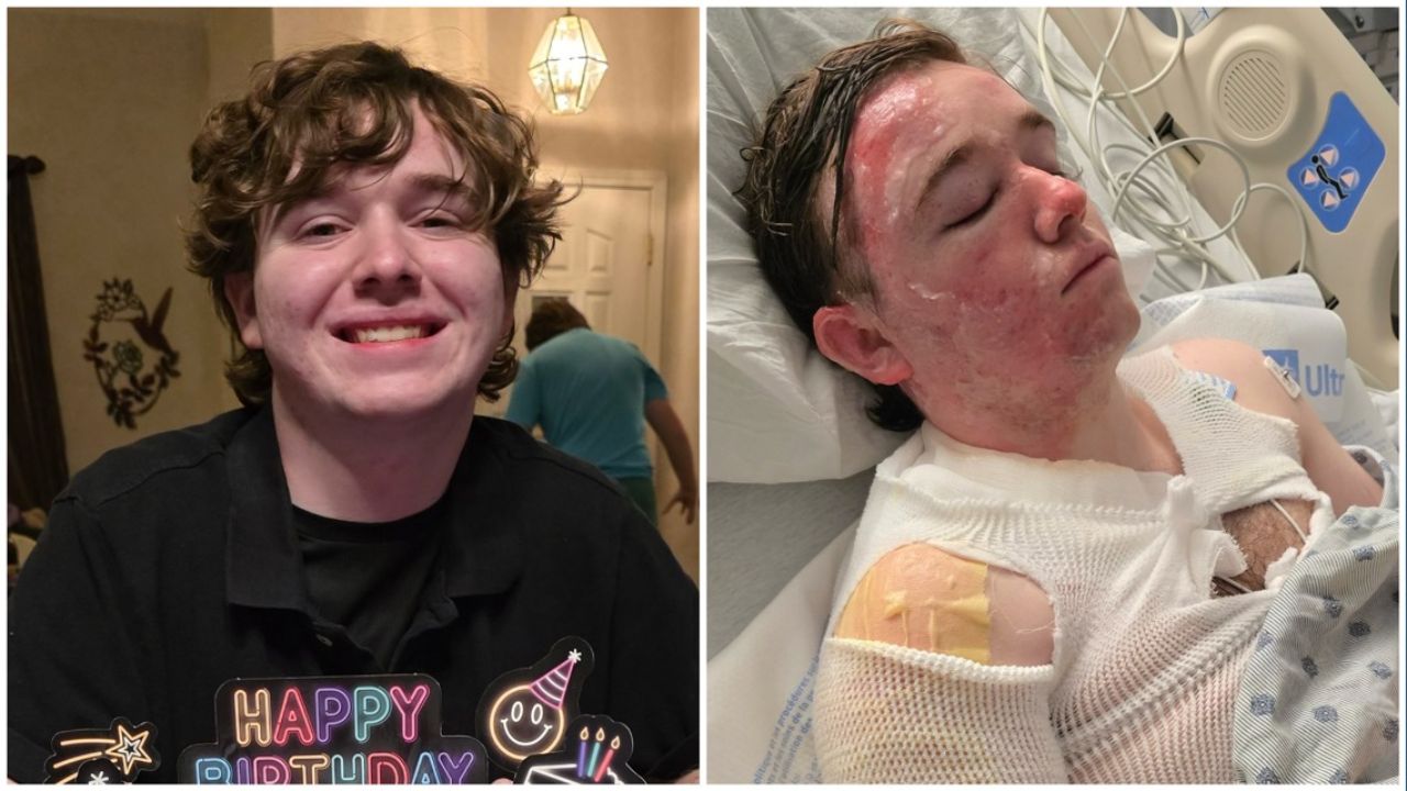 McDonald's worker throws boiling hot oil on 20-year-old manager, leaving him with 3rd-degree burns — and his mom wants justice
