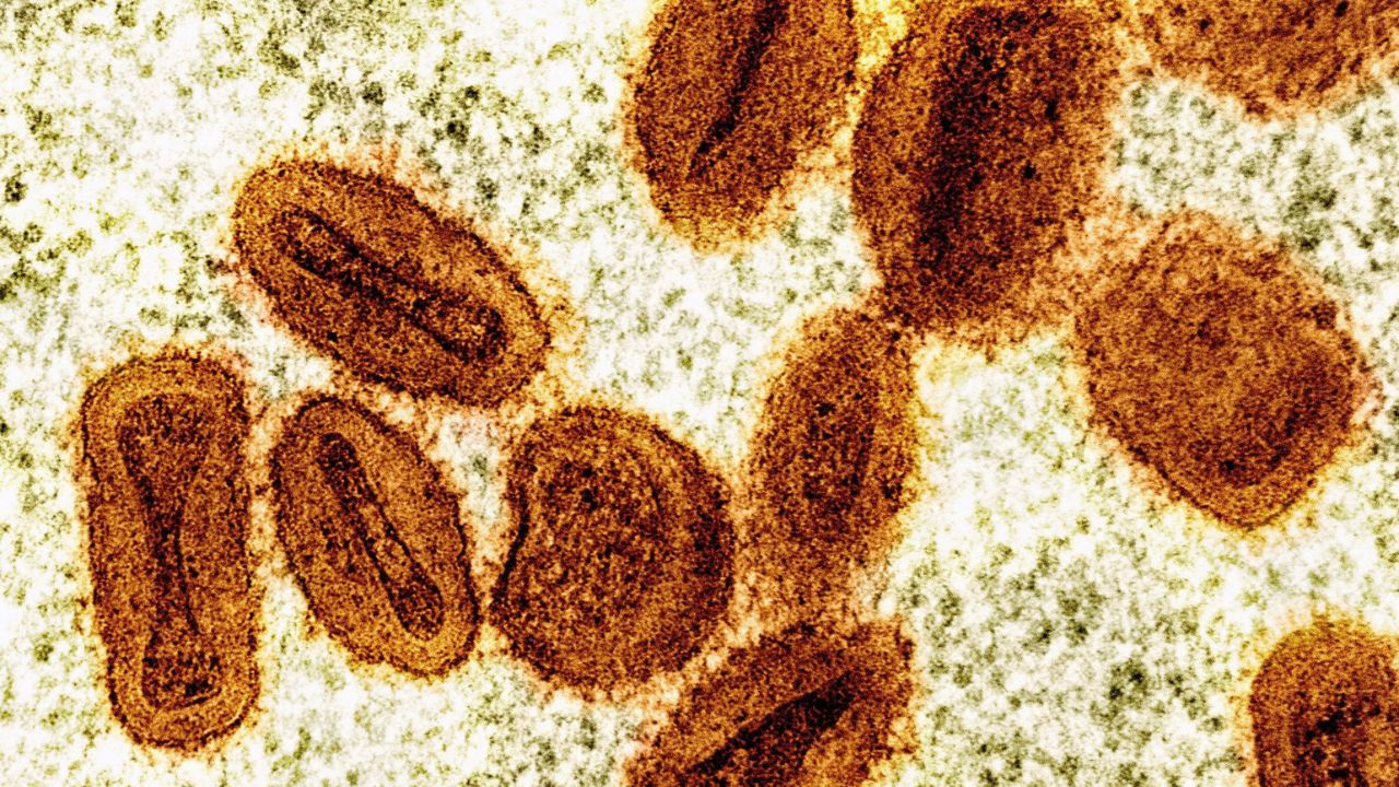 Two Researchers Charged After Alleged Attempt to Bring Mpox-Related Samples Into U.S.